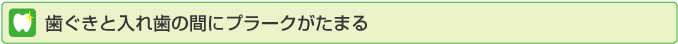 歯ぐきと入れ歯の間にプラークがたまる